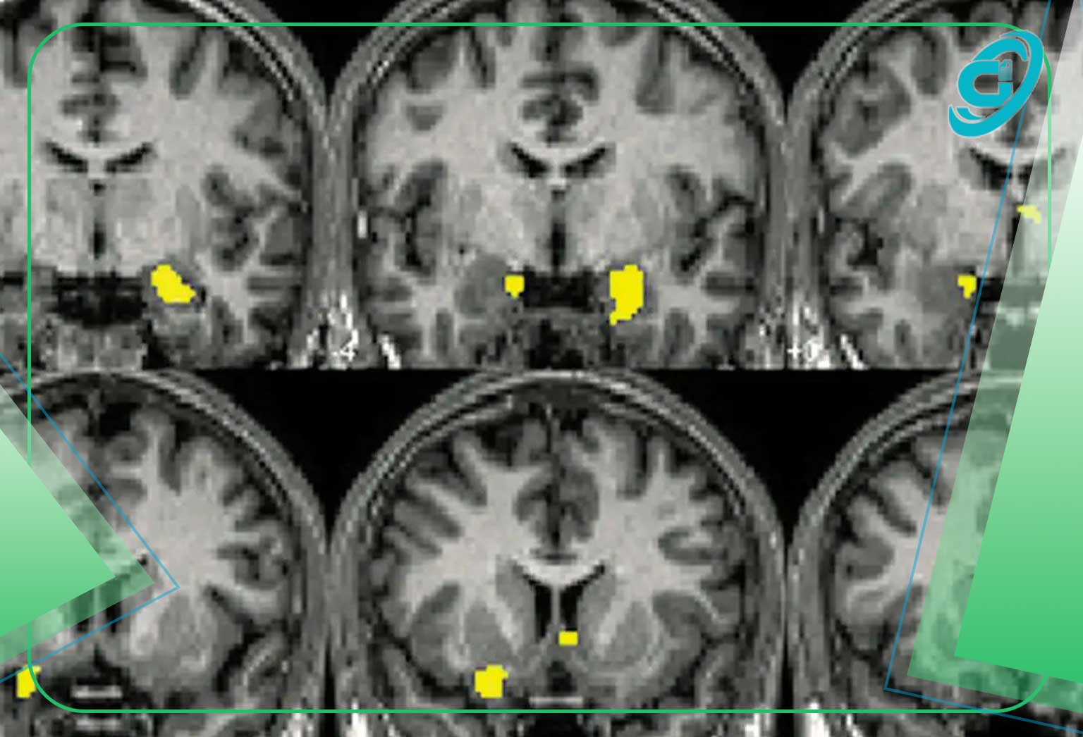 کشف روشی برای خواندن افکار با استفاده از دستگاه MRI