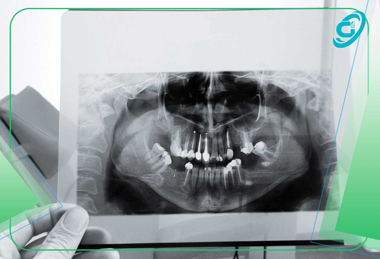 اهمیت تفسیر رادیولوژی فک و صورت در برنامه ریزی درمان دندانپزشکی: